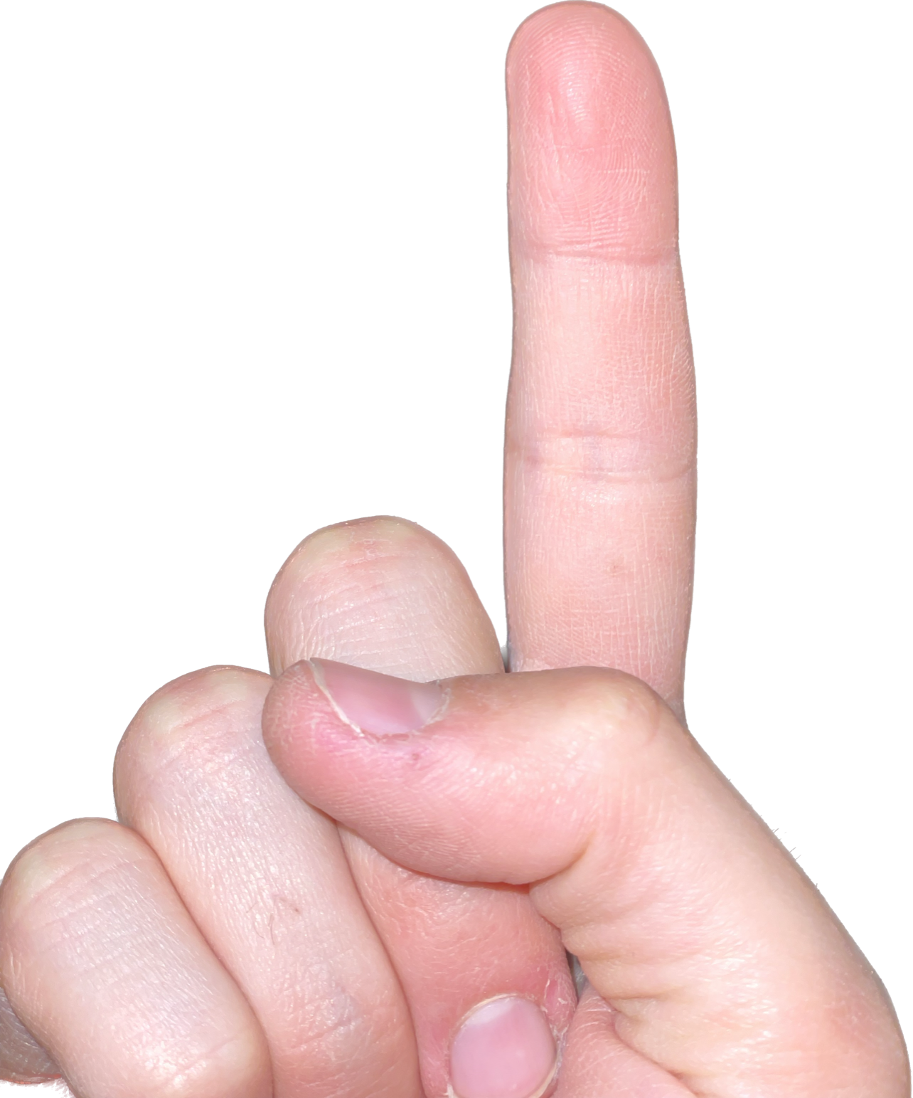 Figure 1: a picture of my finger
